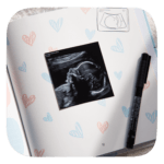 livre de grossesse ouvert sur une page avec des coeurs rose et bleu et une photo d'une échographie